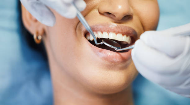 Best Emergency Cosmetic Dentistry (e.g., broken veneers) in Farmington, MS