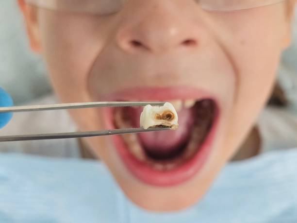 Best Emergency Denture Repair in Farmington, MS